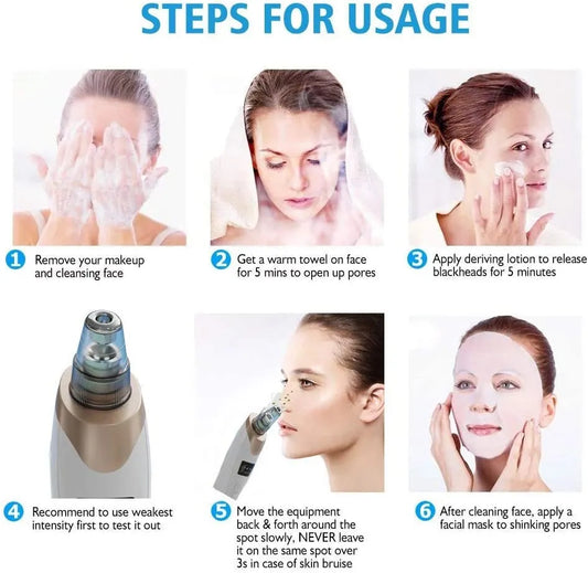 Blackhead Remover Machine 4 in 1