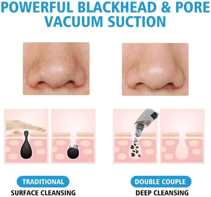 Blackhead Remover Machine 4 in 1