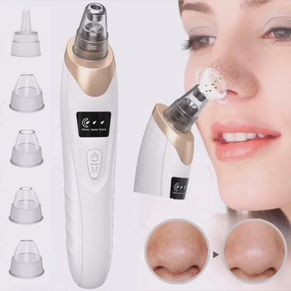 Blackhead Remover Machine 4 in 1